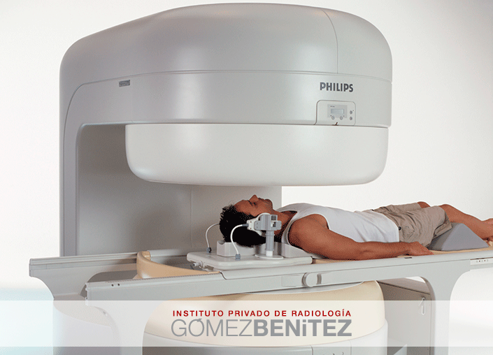 RESONANCIA MAGNÉTICA ABIERTA