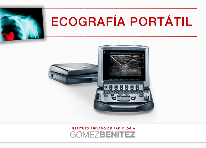 ECOGRAFÍA PORTATIL