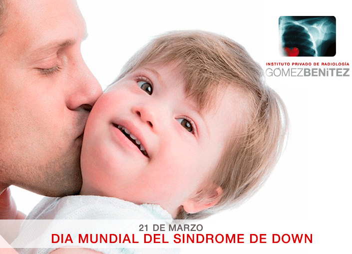 DIA MUNDIAL DEL SINDROME DE DOWN