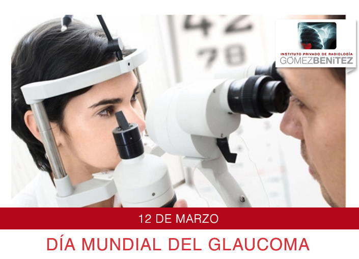 GLAUCOMA: QUE ES Y COMO PREVENIR SU AVANCE